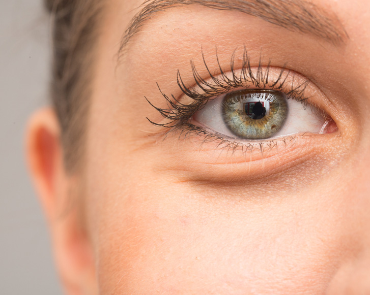 Cirugía Facial 1 Blefaroplastia