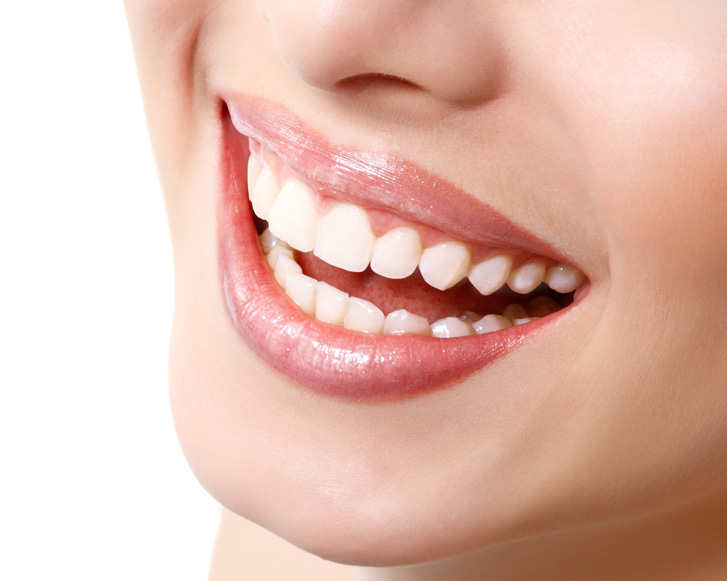 Cirugía Facial 7 Queiloplastia y lifting de labio